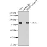 Western Blot - Anti-MCM7/PRL Antibody [ARC0573] (A80798) - Antibodies.com