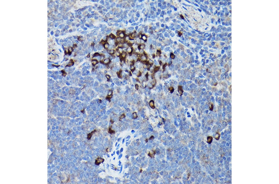 Immunohistochemistry - Anti-DDIT3 Antibody (A80799) - Antibodies.com