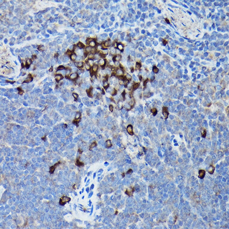 Immunohistochemistry - Anti-DDIT3 Antibody (A80799) - Antibodies.com
