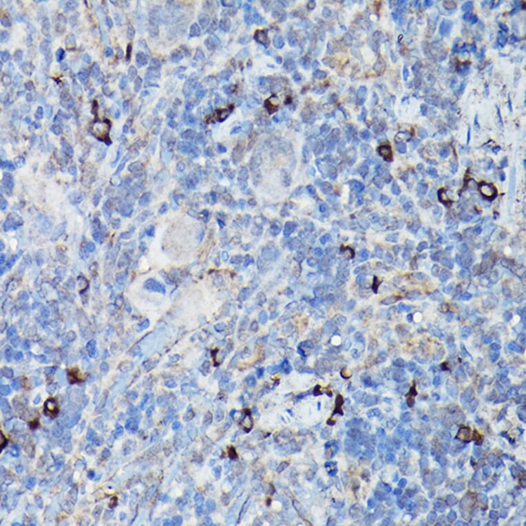 Immunohistochemistry - Anti-DDIT3 Antibody (A80799) - Antibodies.com