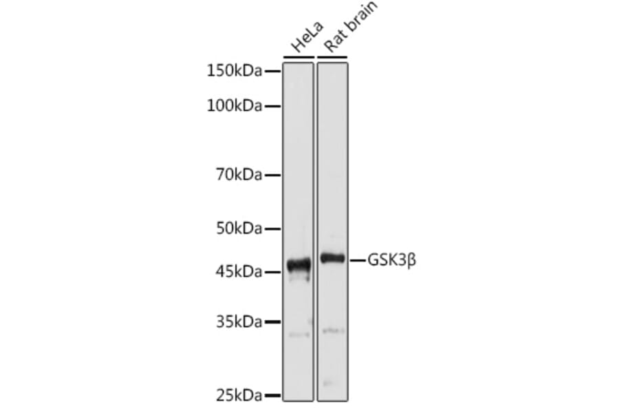 Western Blot - Anti-GSK3 beta Antibody (A80800) - Antibodies.com