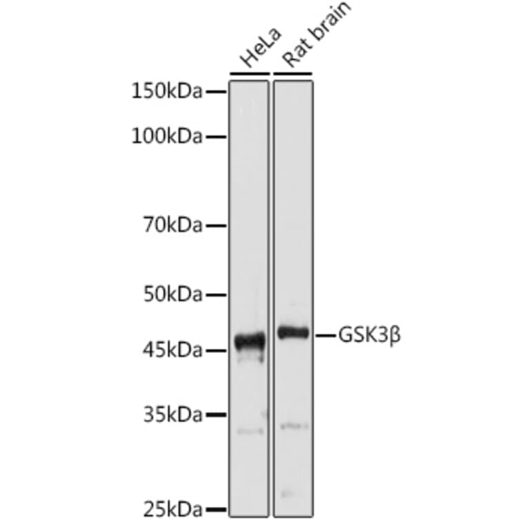 Western Blot - Anti-GSK3 beta Antibody (A80800) - Antibodies.com