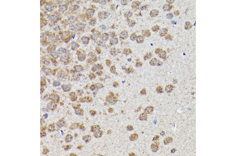 Immunohistochemistry - Anti-GSK3 beta Antibody (A80800) - Antibodies.com