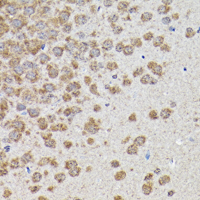 Immunohistochemistry - Anti-GSK3 beta Antibody (A80800) - Antibodies.com