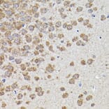 Immunohistochemistry - Anti-GSK3 beta Antibody (A80800) - Antibodies.com
