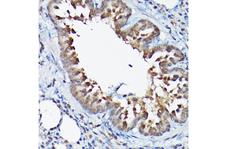 Immunohistochemistry - Anti-GSK3 beta Antibody (A80800) - Antibodies.com