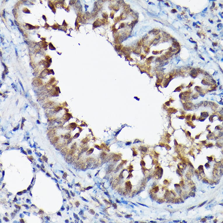 Immunohistochemistry - Anti-GSK3 beta Antibody (A80800) - Antibodies.com