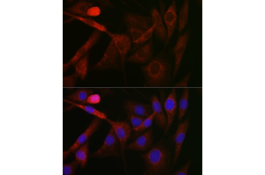 Immunofluorescence - Anti-GSK3 beta Antibody (A80800) - Antibodies.com