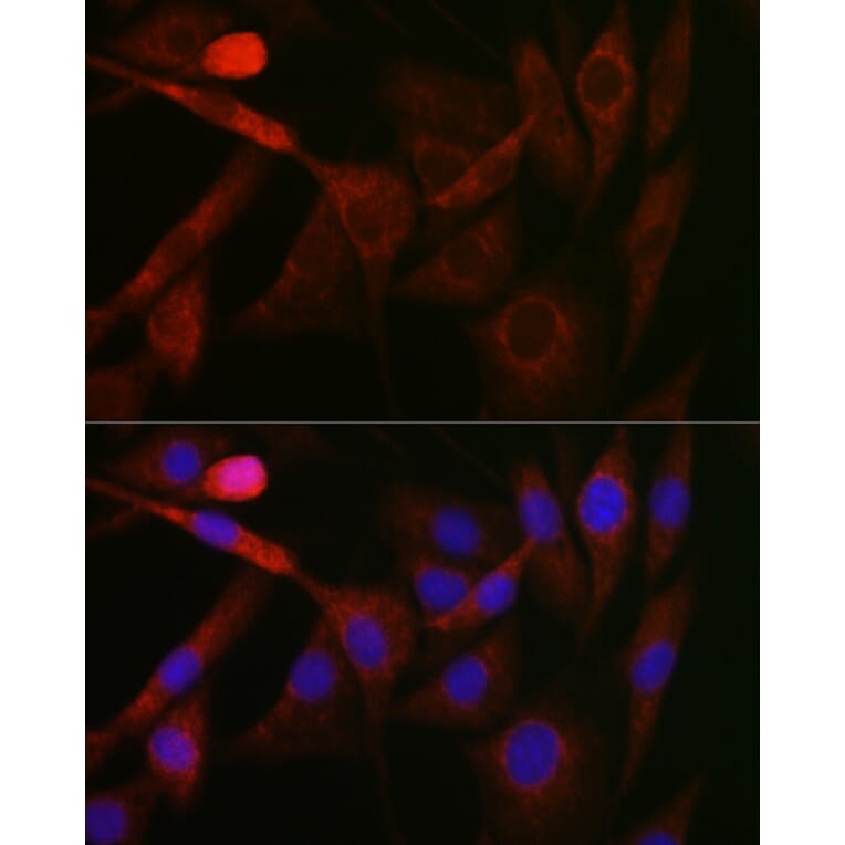 Immunofluorescence - Anti-GSK3 beta Antibody (A80800) - Antibodies.com