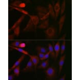 Immunofluorescence - Anti-GSK3 beta Antibody (A80800) - Antibodies.com