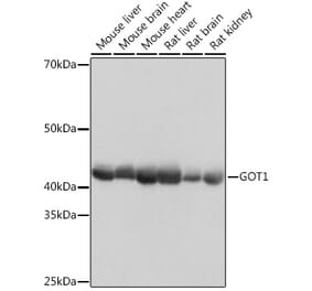 Western Blot - Anti-Aspartate Aminotransferase Antibody [ARC0579] (A80801) - Antibodies.com