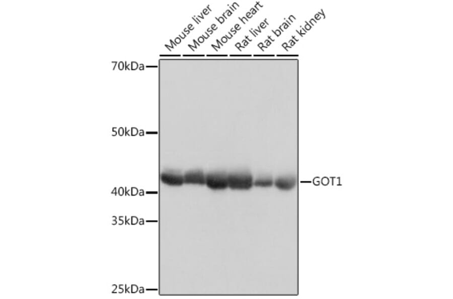 Western Blot - Anti-Aspartate Aminotransferase Antibody [ARC0579] (A80801) - Antibodies.com