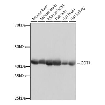 Western Blot - Anti-Aspartate Aminotransferase Antibody [ARC0579] (A80801) - Antibodies.com