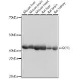 Western Blot - Anti-Aspartate Aminotransferase Antibody [ARC0579] (A80801) - Antibodies.com