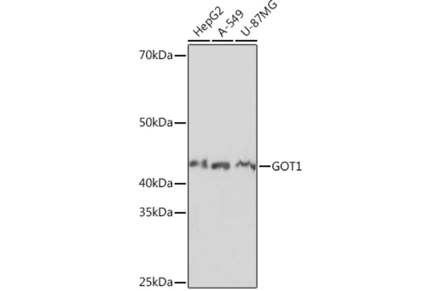 Western Blot - Anti-Aspartate Aminotransferase Antibody [ARC0579] (A80801) - Antibodies.com