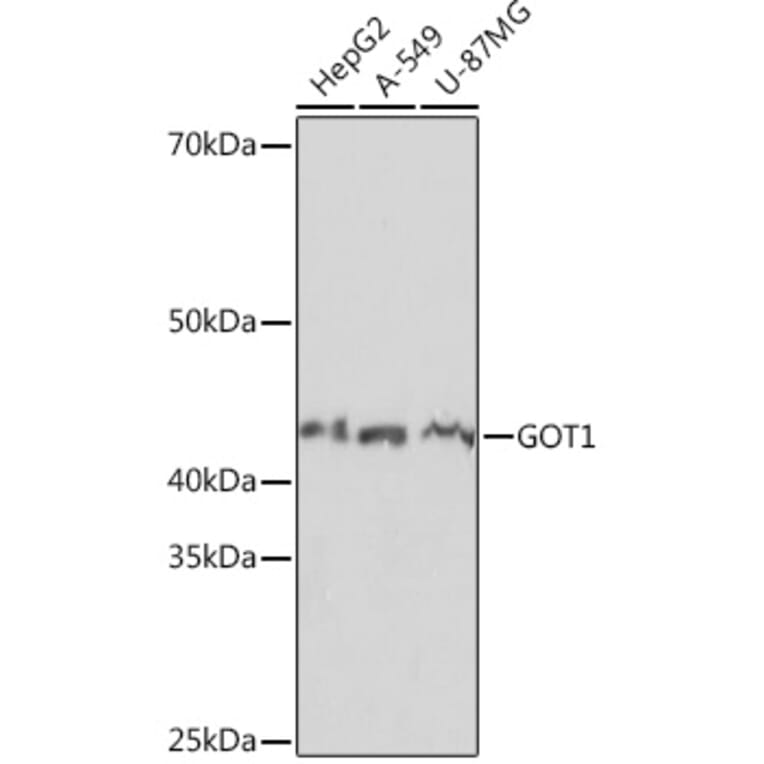 Western Blot - Anti-Aspartate Aminotransferase Antibody [ARC0579] (A80801) - Antibodies.com