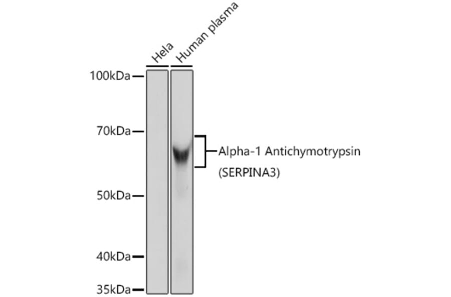 Western Blot - Anti-AACT Antibody [ARC0581] (A80802) - Antibodies.com