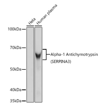 Western Blot - Anti-AACT Antibody [ARC0581] (A80802) - Antibodies.com