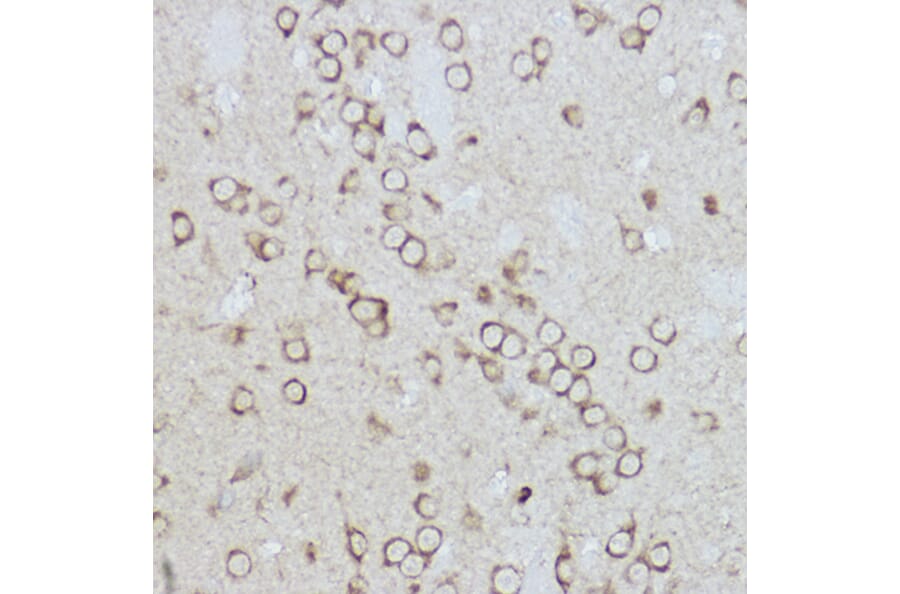 Immunohistochemistry - Anti-GRP78 BiP Antibody (A80803) - Antibodies.com