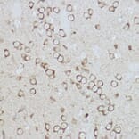 Immunohistochemistry - Anti-GRP78 BiP Antibody (A80803) - Antibodies.com