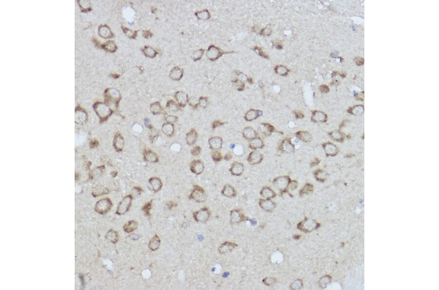 Immunohistochemistry - Anti-GRP78 BiP Antibody (A80803) - Antibodies.com