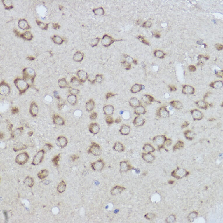 Immunohistochemistry - Anti-GRP78 BiP Antibody (A80803) - Antibodies.com