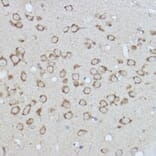 Immunohistochemistry - Anti-GRP78 BiP Antibody (A80803) - Antibodies.com