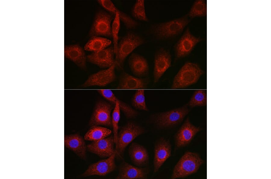 Immunofluorescence - Anti-GRP78 BiP Antibody (A80803) - Antibodies.com