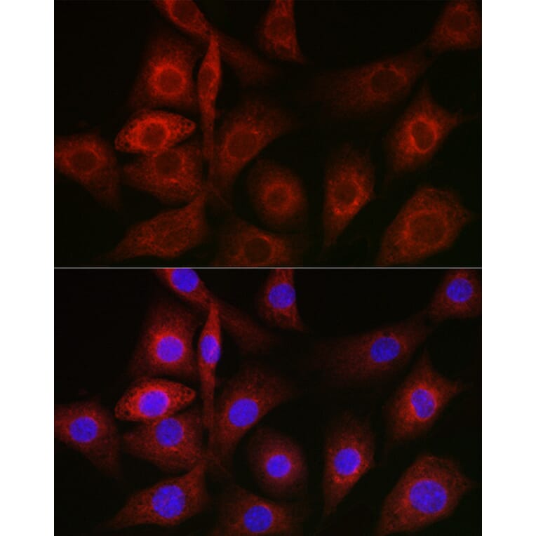 Immunofluorescence - Anti-GRP78 BiP Antibody (A80803) - Antibodies.com