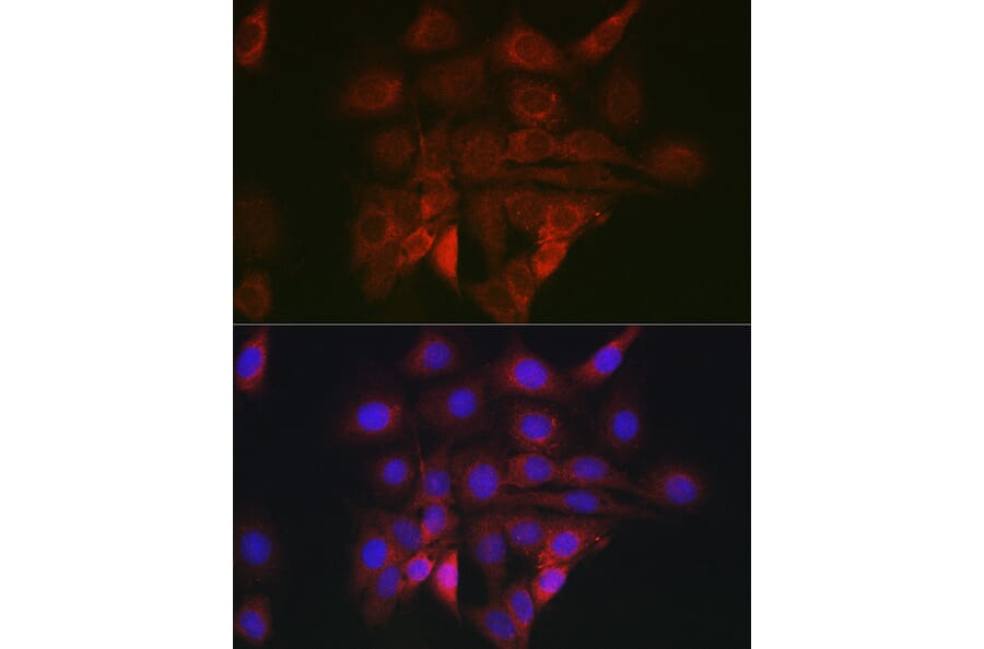 Immunofluorescence - Anti-GRP78 BiP Antibody (A80803) - Antibodies.com
