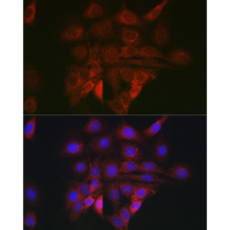 Immunofluorescence - Anti-GRP78 BiP Antibody (A80803) - Antibodies.com