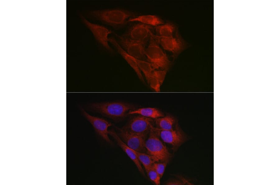 Immunofluorescence - Anti-GRP78 BiP Antibody (A80803) - Antibodies.com