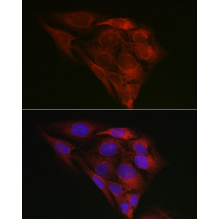 Immunofluorescence - Anti-GRP78 BiP Antibody (A80803) - Antibodies.com