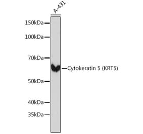 Western Blot - Anti-Cytokeratin 5 Antibody [ARC0585] (A80808) - Antibodies.com