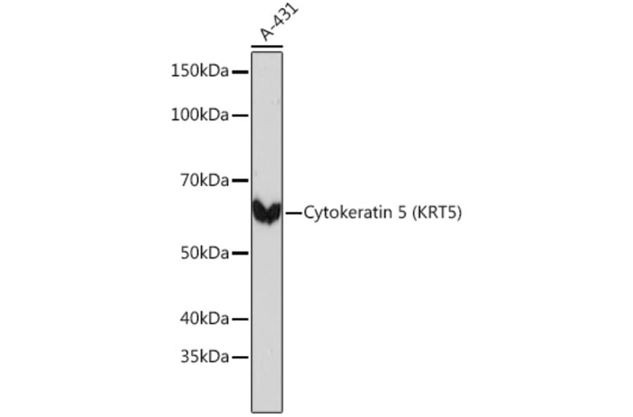 Western Blot - Anti-Cytokeratin 5 Antibody [ARC0585] (A80808) - Antibodies.com