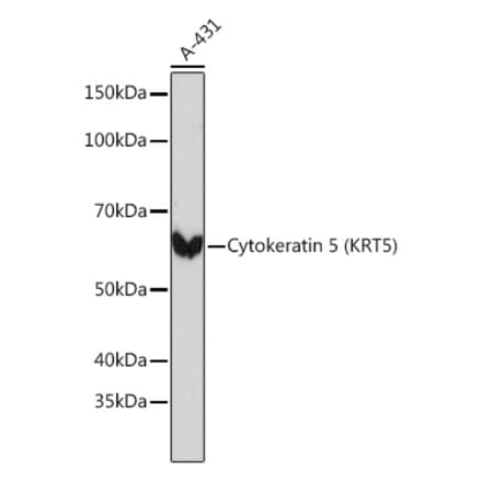 Western Blot - Anti-Cytokeratin 5 Antibody [ARC0585] (A80808) - Antibodies.com