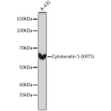 Western Blot - Anti-Cytokeratin 5 Antibody [ARC0585] (A80808) - Antibodies.com