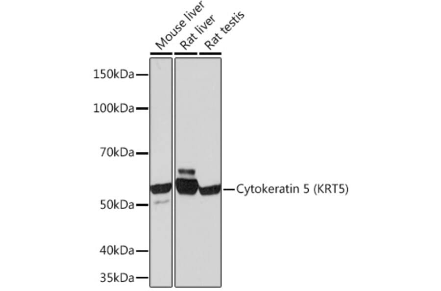 Western Blot - Anti-Cytokeratin 5 Antibody [ARC0585] (A80808) - Antibodies.com