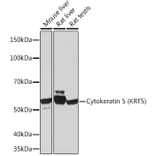 Western Blot - Anti-Cytokeratin 5 Antibody [ARC0585] (A80808) - Antibodies.com
