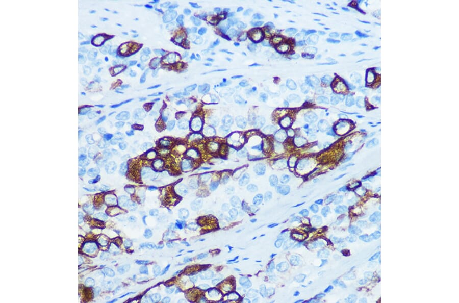 Immunohistochemistry - Anti-Cytokeratin 5 Antibody [ARC0585] (A80808) - Antibodies.com