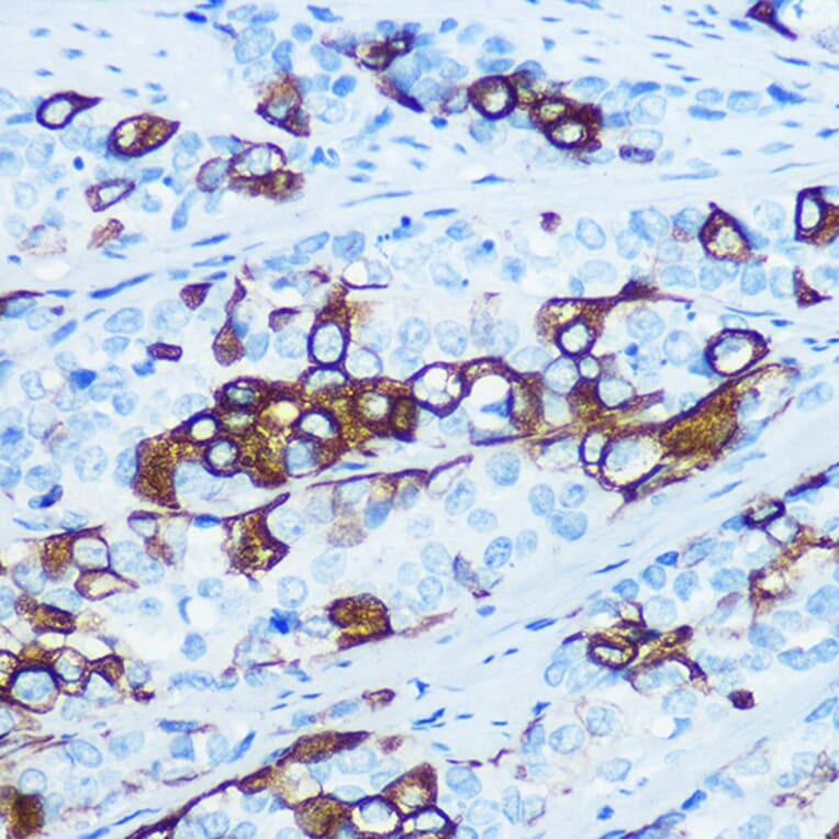 Immunohistochemistry - Anti-Cytokeratin 5 Antibody [ARC0585] (A80808) - Antibodies.com