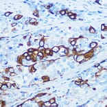 Immunohistochemistry - Anti-Cytokeratin 5 Antibody [ARC0585] (A80808) - Antibodies.com