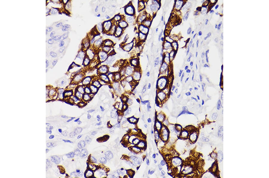Immunohistochemistry - Anti-Cytokeratin 5 Antibody [ARC0585] (A80808) - Antibodies.com