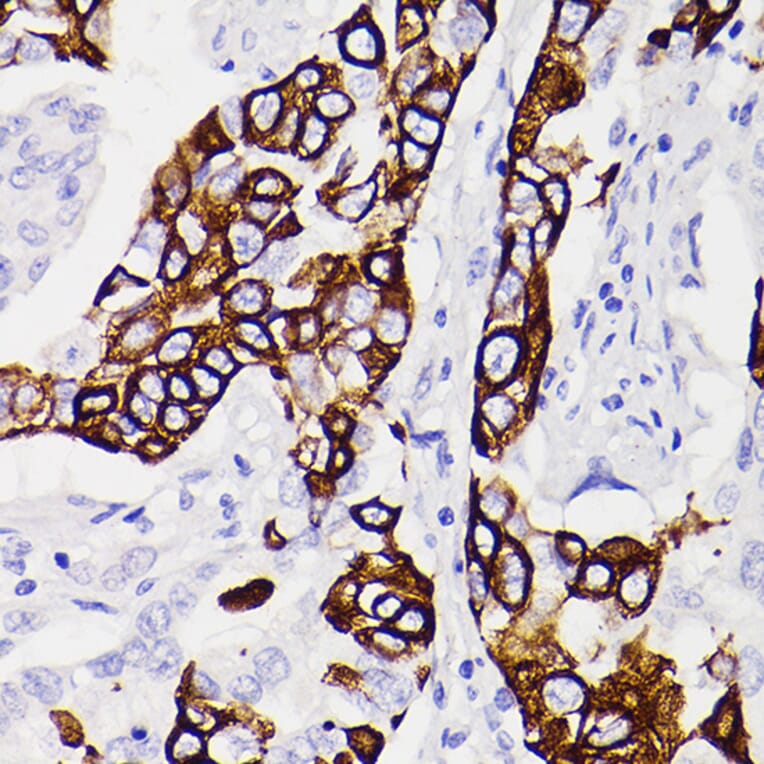 Immunohistochemistry - Anti-Cytokeratin 5 Antibody [ARC0585] (A80808) - Antibodies.com