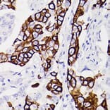Immunohistochemistry - Anti-Cytokeratin 5 Antibody [ARC0585] (A80808) - Antibodies.com