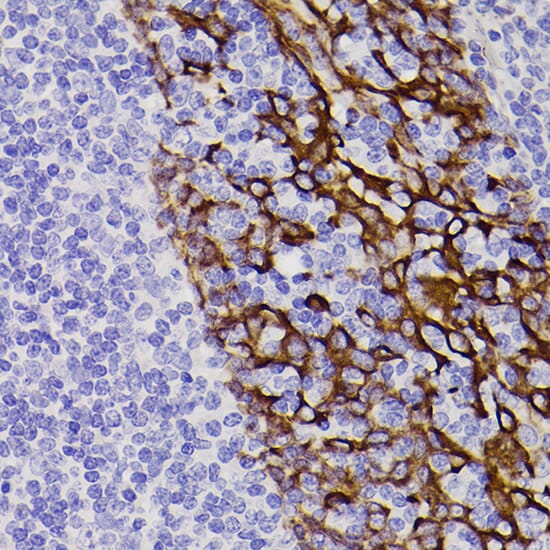 Anti-Cytokeratin 5 Antibody [ARC0585] (A80808) | Antibodies.com