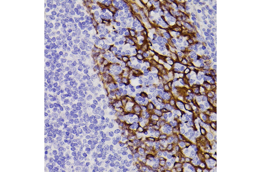 Immunohistochemistry - Anti-Cytokeratin 5 Antibody [ARC0585] (A80808) - Antibodies.com