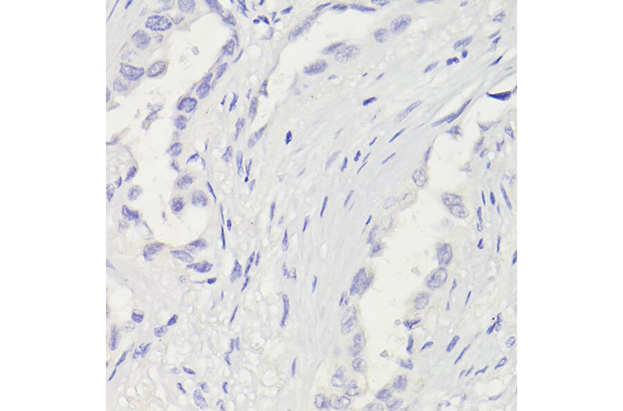 Immunohistochemistry - Anti-Cytokeratin 5 Antibody [ARC0585] (A80808) - Antibodies.com