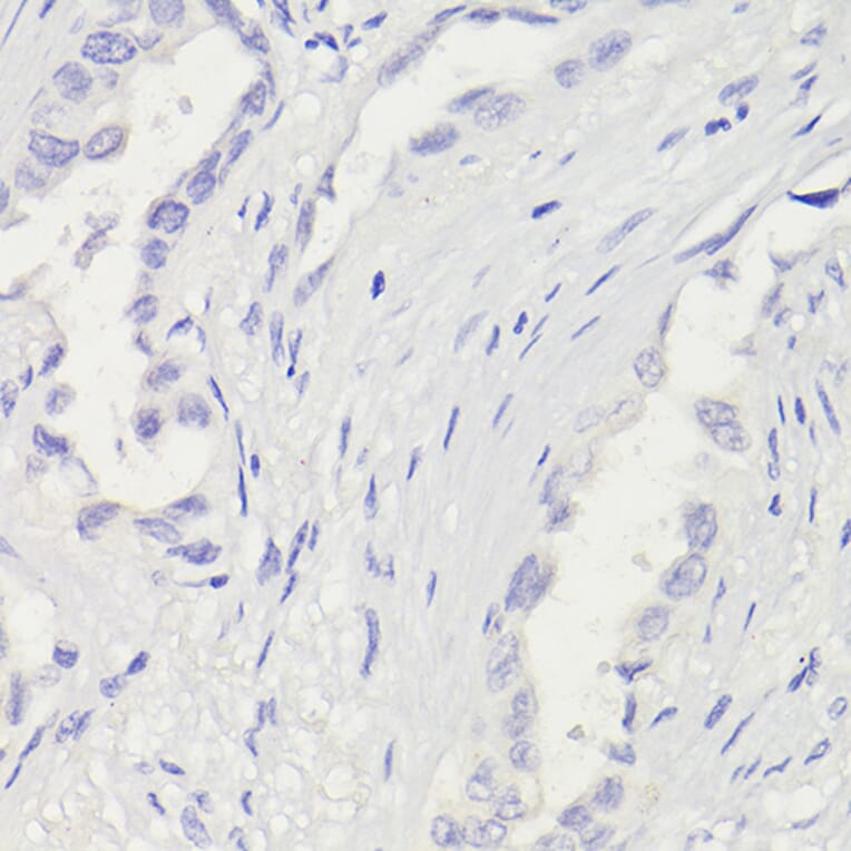 Immunohistochemistry - Anti-Cytokeratin 5 Antibody [ARC0585] (A80808) - Antibodies.com
