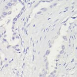 Immunohistochemistry - Anti-Cytokeratin 5 Antibody [ARC0585] (A80808) - Antibodies.com